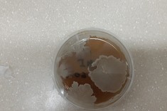 Photo of strain Bacillus subtlis MSP